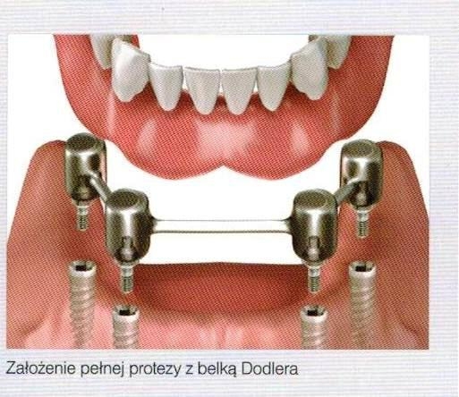 Niepubliczny Zakład Opieki Zdrowotnej RP Dent