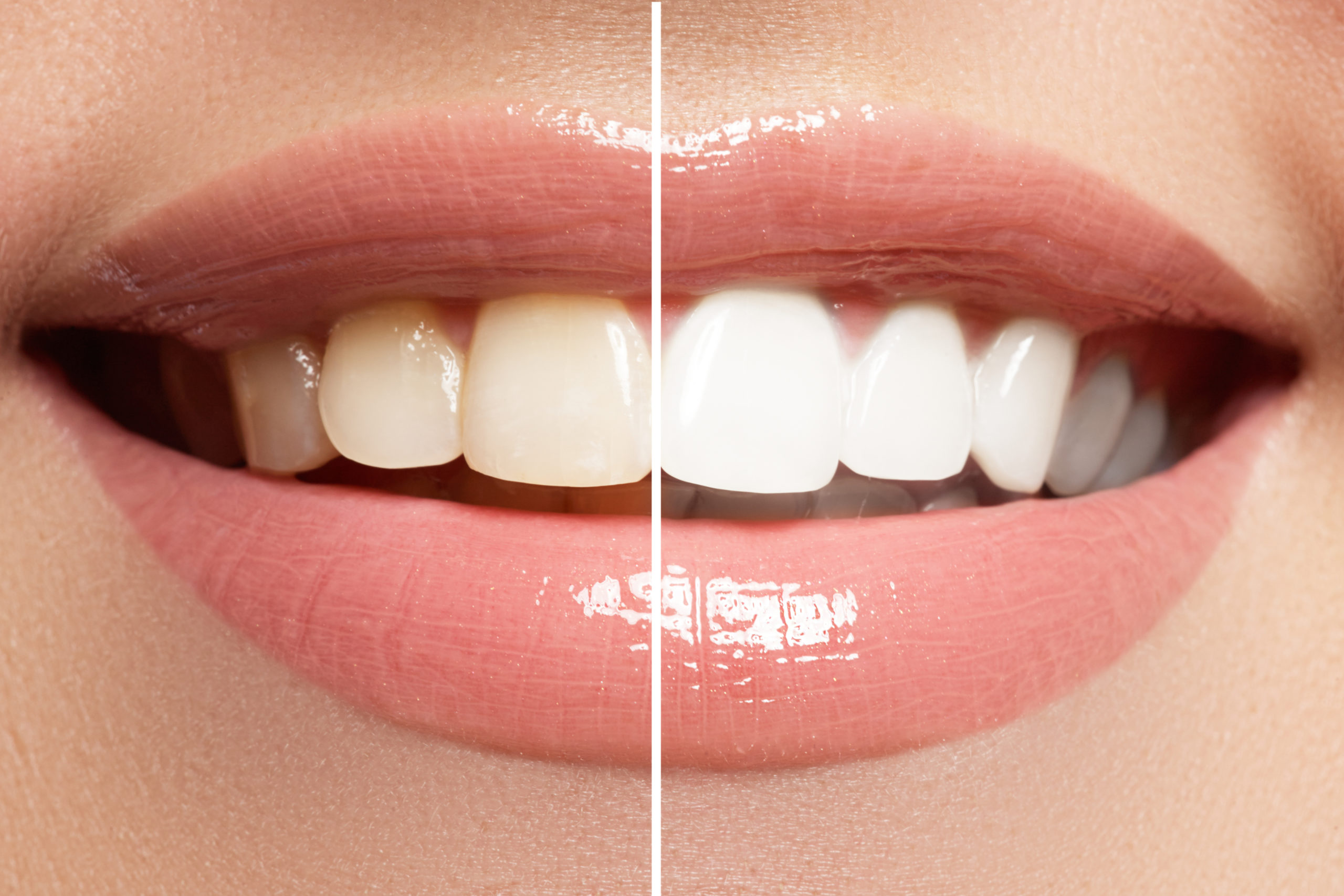 Dental Spa