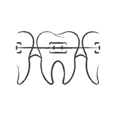 Royal Dent