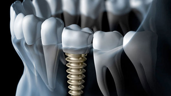 Dental Services