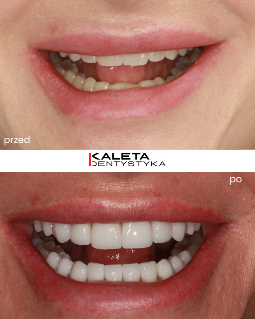 Kaleta Dentystyka