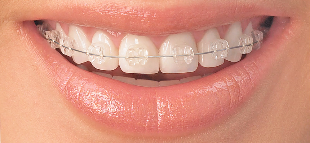 Emident