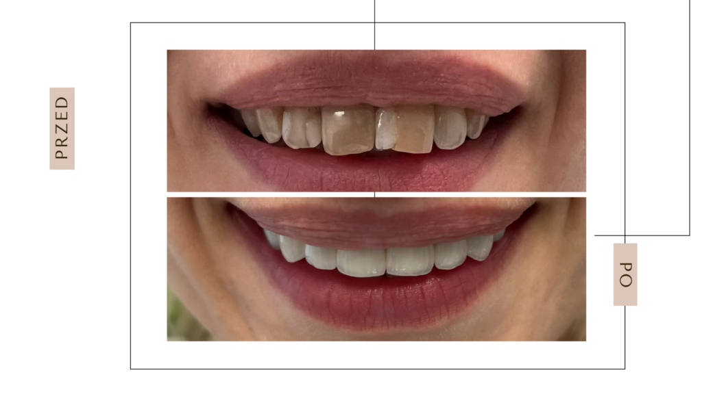 TOP:-DENT
