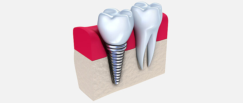 Dental Nova
