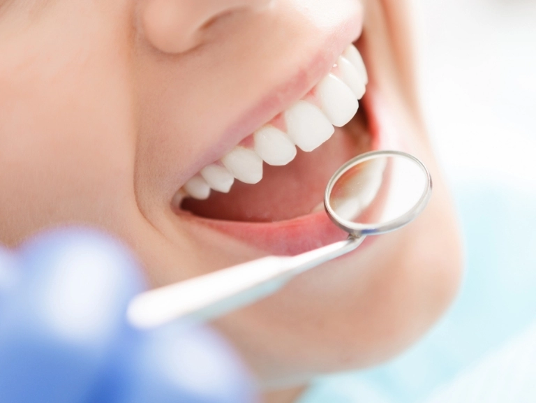 Dentes