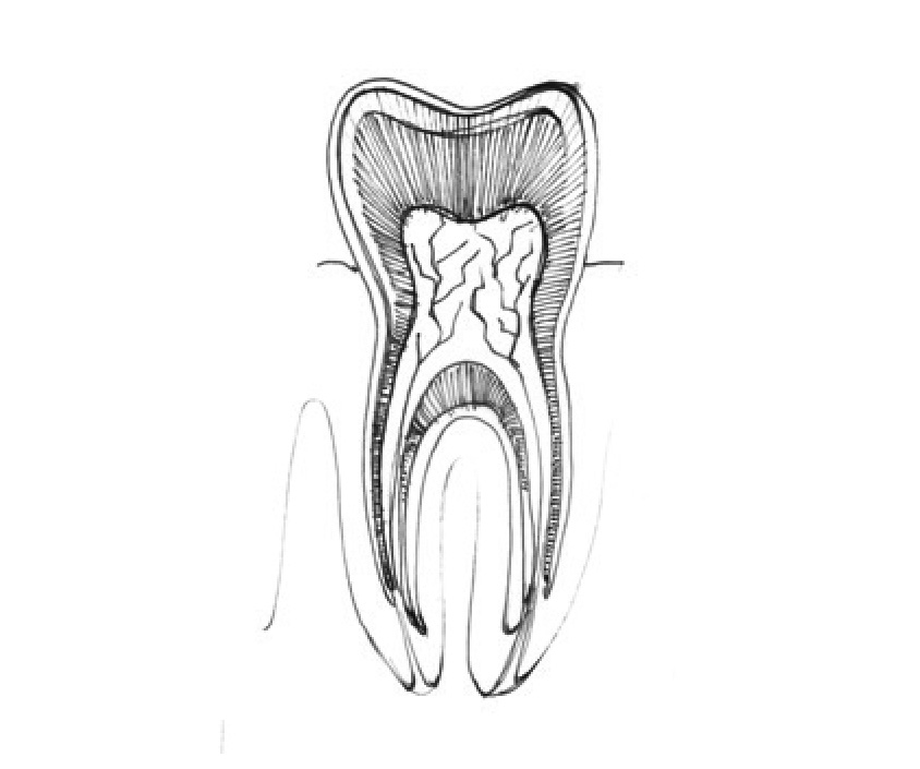 Avidental