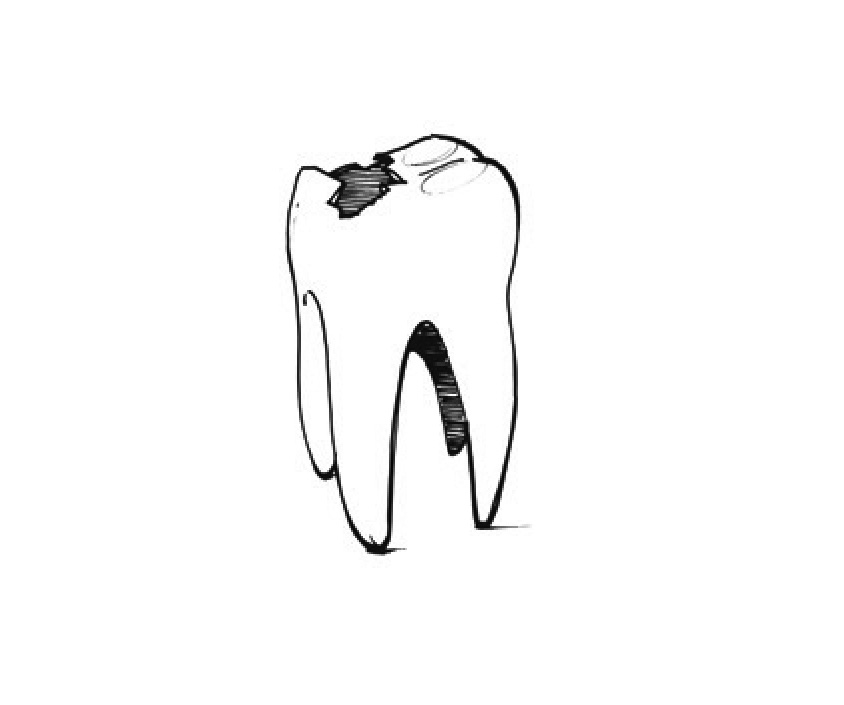Avidental
