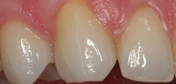 Dens Stomatologia