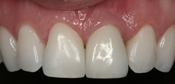 Dens Stomatologia