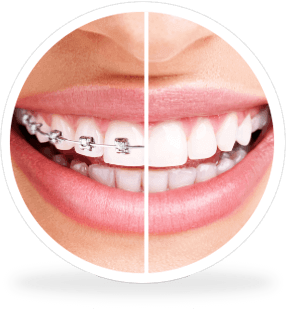 Uldent