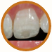 Dental Care