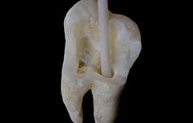 Implant Medical