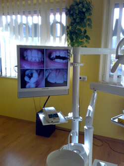 C-Dent