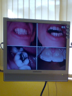 C-Dent