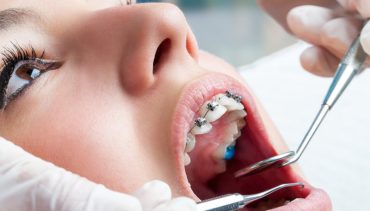 S-Dent