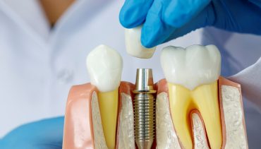 S-Dent