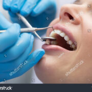 Logo Dentalking